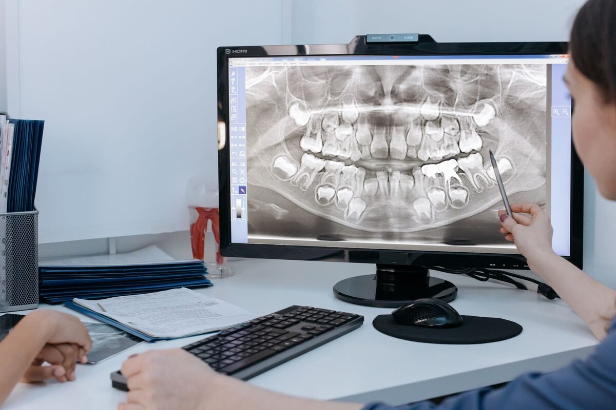 Cracked or Chipped Tooth: When Is It an Emergency?