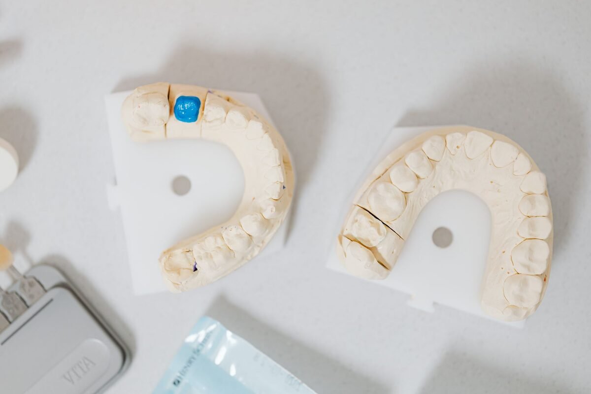 Dental Crowns
