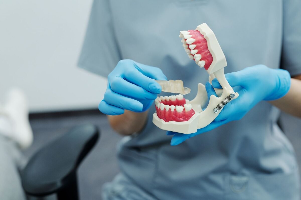 Full-arch dental implant model showing a complete row of teeth supported by implant posts